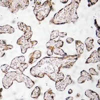 PEDF Rabbit Polyclonal Antibody