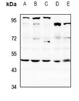 SAP49 Rabbit Polyclonal Antibody