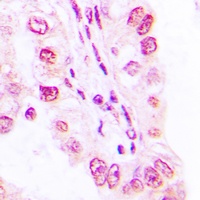 SAP49 Rabbit Polyclonal Antibody