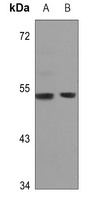 GPR172B Rabbit Polyclonal Antibody