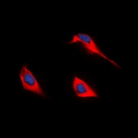 GPR172B Rabbit Polyclonal Antibody