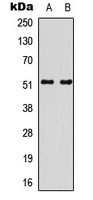 SMAD3 (Phospho-S213) Rabbit Polyclonal Antibody