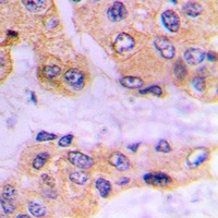 SMAD3 (Phospho-S213) Rabbit Polyclonal Antibody