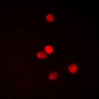 SNAI1 (Phospho-S246) Rabbit Polyclonal Antibody