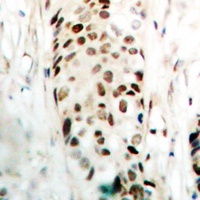 SOX9 Rabbit Polyclonal Antibody