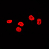 SOX9 Rabbit Polyclonal Antibody