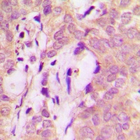 STAM2 Rabbit Polyclonal Antibody
