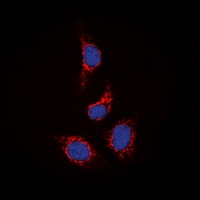 STAM2 Rabbit Polyclonal Antibody