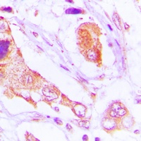 TAO1 Rabbit Polyclonal Antibody