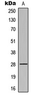 cTnI (Phospho-S43) Rabbit Polyclonal Antibody