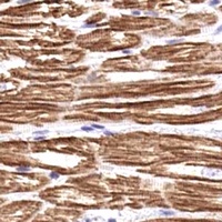 cTnI (Phospho-S43) Rabbit Polyclonal Antibody