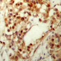 p53 (Phospho-S9) Rabbit Polyclonal Antibody