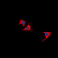 TUSC5 Rabbit Polyclonal Antibody