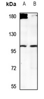 USP38 Rabbit Polyclonal Antibody