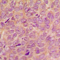 VAV2 (Phospho-Y142) Rabbit Polyclonal Antibody