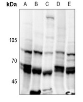 NIPA (Phospho-S354) Rabbit Polyclonal Antibody