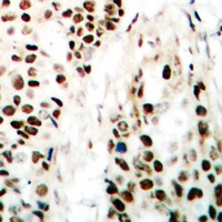 NIPA Rabbit Polyclonal Antibody