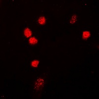 NIPA Rabbit Polyclonal Antibody