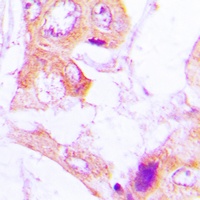 ACC alpha (Phospho-S80) Rabbit Polyclonal Antibody