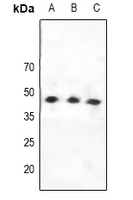 CCKAR Rabbit Polyclonal Antibody