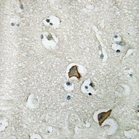 CCKAR Rabbit Polyclonal Antibody
