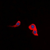 CCKAR Rabbit Polyclonal Antibody