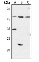 CD1d Rabbit Polyclonal Antibody