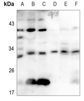 CD69 Rabbit Polyclonal Antibody
