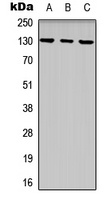 EPHB1 Rabbit Polyclonal Antibody