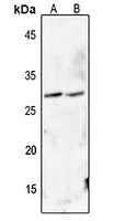 FADD (Phospho-S194) Rabbit Polyclonal Antibody