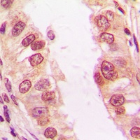 FADD (Phospho-S194) Rabbit Polyclonal Antibody