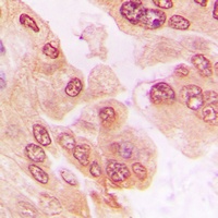 FOXO1 (Phospho-S329) Rabbit Polyclonal Antibody