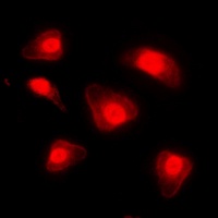 FOXO1 (Phospho-S329) Rabbit Polyclonal Antibody