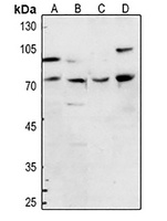 FOXP1 Rabbit Polyclonal Antibody