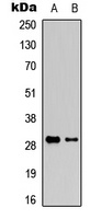 Granzyme K Rabbit Polyclonal Antibody