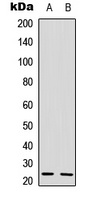 IL-22 Rabbit Polyclonal Antibody