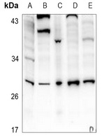 IL-6 Rabbit Polyclonal Antibody