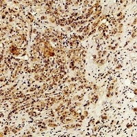 IL-6 Rabbit Polyclonal Antibody