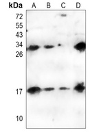 IL-6 Rabbit Polyclonal Antibody