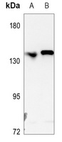 L1CAM Rabbit Polyclonal Antibody