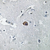 L1CAM Rabbit Polyclonal Antibody