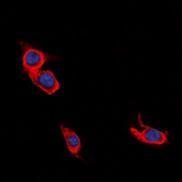 L1CAM Rabbit Polyclonal Antibody