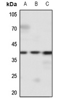 EDG2 Rabbit Polyclonal Antibody