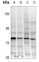 TAK1 (Phospho-T187) Rabbit Polyclonal Antibody