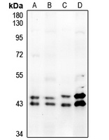 ERK1/2 (Phospho-T202/Y204) Rabbit Polyclonal Antibody