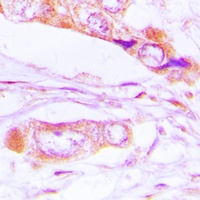 ERK1/2 (Phospho-T202/Y204) Rabbit Polyclonal Antibody