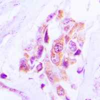 MARK Rabbit Polyclonal Antibody