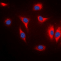 MARK Rabbit Polyclonal Antibody