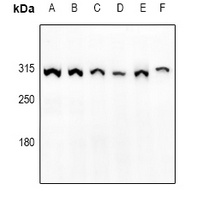mTOR (Phospho-S2448) Rabbit Polyclonal Antibody