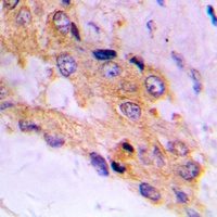 mTOR (Phospho-S2448) Rabbit Polyclonal Antibody